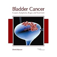 Bladder Cancer: Causes, Symptoms, Stages and Treatment