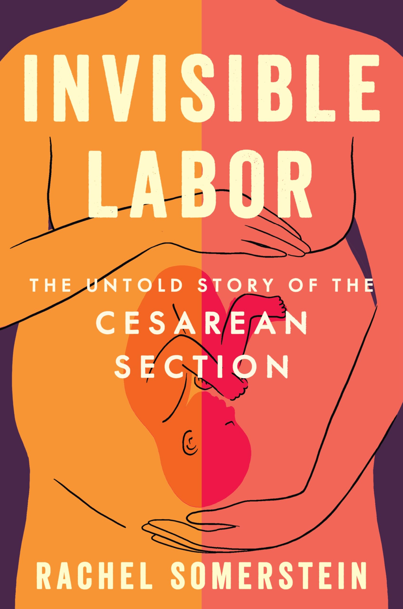Invisible Labor: The Untold Story of the Cesarean Section