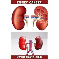 KIDNEY CANCER: Step By Step Guide On How To Heal Your Kidney And Live Healthily
