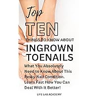 Top Ten Things To Know About Ingrown Toenails: What You Absolutely Need to Know About This Pesky Nail Condition. Learn Fast How You Can Deal With It Better! (Top Ten Things To Know (4TK Guides)) Top Ten Things To Know About Ingrown Toenails: What You Absolutely Need to Know About This Pesky Nail Condition. Learn Fast How You Can Deal With It Better! (Top Ten Things To Know (4TK Guides)) Kindle