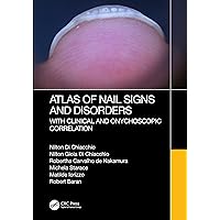 Atlas of Nail Signs and Disorders with Clinical and Onychoscopic Correlation Atlas of Nail Signs and Disorders with Clinical and Onychoscopic Correlation Hardcover Kindle