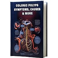 Colonic Polyps Symptoms, Causes & More: Gain insights into Colonic Polyps – their symptoms, causes, and implications – in this comprehensive guide to digestive health. Colonic Polyps Symptoms, Causes & More: Gain insights into Colonic Polyps – their symptoms, causes, and implications – in this comprehensive guide to digestive health. Paperback