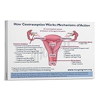 QHIUCS Posters of Emergency Contraceptive Measures Family Planning Poster (1) Canvas Painting Posters And Prints Wall Art Pictures for Living Room Bedroom Decor 08x12inch(20x30cm) Frame-style