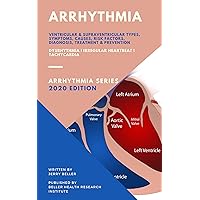 Arrhythmia: Dysrhythmia | Irregular Heartbeat | Tachycardia (Arrhythmia Types, Causes, Symptoms, Diagnosis, Treatment, Risk Factors, & Prevention Book 1) Arrhythmia: Dysrhythmia | Irregular Heartbeat | Tachycardia (Arrhythmia Types, Causes, Symptoms, Diagnosis, Treatment, Risk Factors, & Prevention Book 1) Kindle