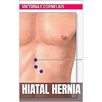 Hiatal Hernia (Hiatal Hernia -Surgery)