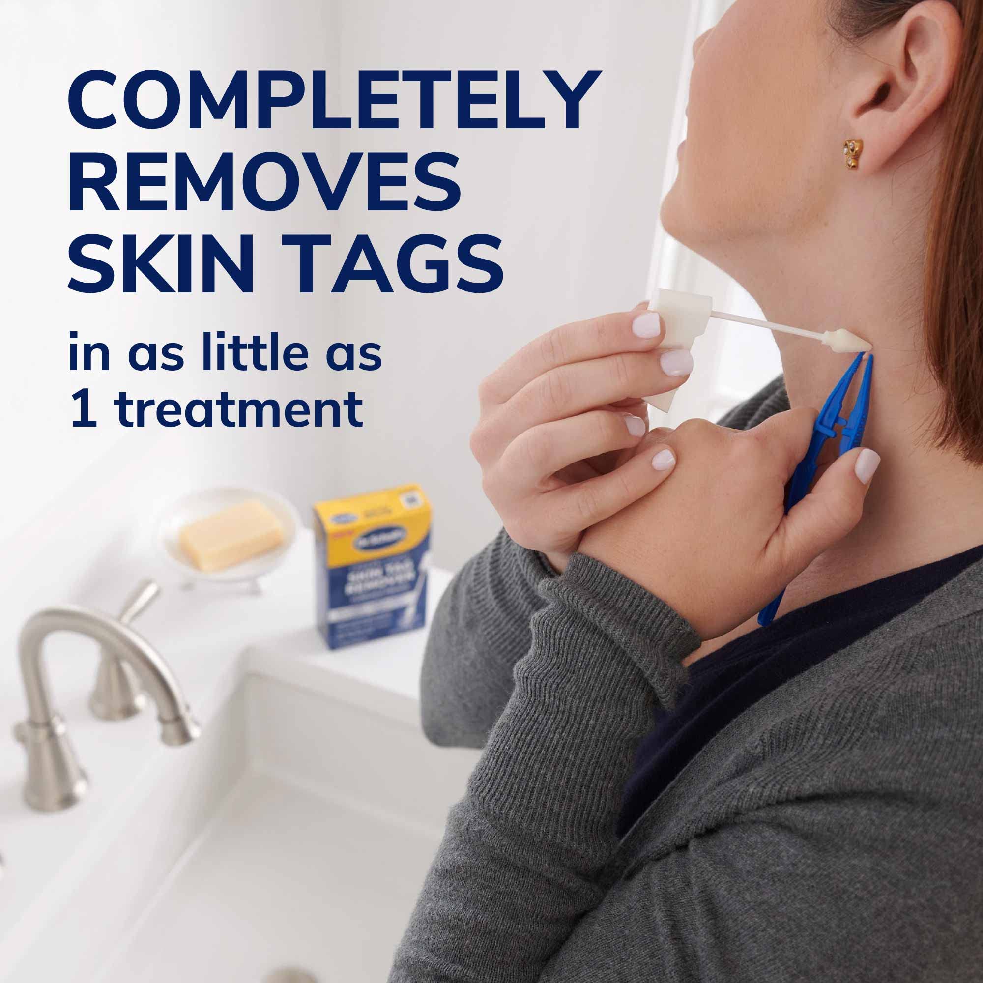 Dr. Scholl's Freeze Away Skin Tag Remover, 8 Ct // Removes Skin Tags in As Little As 1 Treatment, FDA-Cleared, Clinically Proven, 8 Treatments