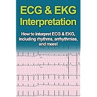 ECG & EKG Interpretation: How to interpret ECG & EKG, including rhythms, arrhythmias, and more! ECG & EKG Interpretation: How to interpret ECG & EKG, including rhythms, arrhythmias, and more! Paperback