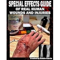 Special Effects Guide Of Real Human Wounds and Injuries: Special Effects Guide Of Real Human Wounds and Injuries Special Effects Guide Of Real Human Wounds and Injuries: Special Effects Guide Of Real Human Wounds and Injuries Paperback Kindle Hardcover