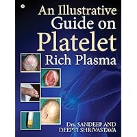 An Illustrative Guide on Platelet Rich Plasma An Illustrative Guide on Platelet Rich Plasma Paperback Kindle