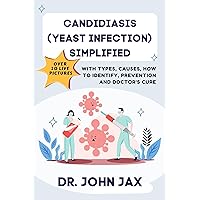 CANDIDIASIS (YEAST INFECTION) SIMPLIFIED: ALSO WITH LIVE PICTURES, TYPES, CAUSES, PREVENTION AND DOCTOR’S CURE. CANDIDIASIS (YEAST INFECTION) SIMPLIFIED: ALSO WITH LIVE PICTURES, TYPES, CAUSES, PREVENTION AND DOCTOR’S CURE. Kindle Hardcover Paperback