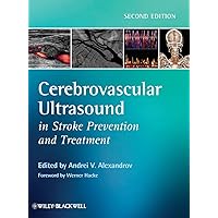 Cerebrovascular Ultrasound in Stroke Prevention and Treatment Cerebrovascular Ultrasound in Stroke Prevention and Treatment Hardcover Kindle