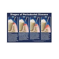 GJEIUD Stages of Periodontal Disease Poster Oral Health Knowledge Poster Canvas Painting Wall Art Poster for Bedroom Living Room Decor 12x18inch(30x45cm) Unframe-style