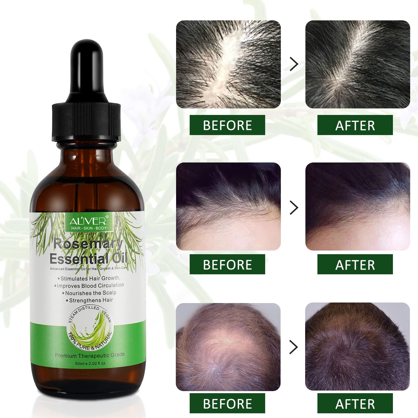 Rosemary Oil for Hair Growth, Organic Rosemary Essential Oils for Skin Care, Nourishes The Scalp,Stimulates Hair Growth, Hair Loss Treatment, Rid of Itchy and Dry Scalp (2.02 fl oz)