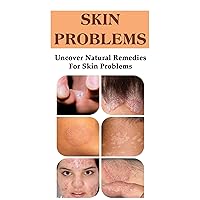 Skin Problems: Uncover Natural Remedies For Skin Problems