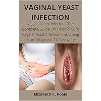 VAGINAL YEAST INFECTION: Vaginal Yeast Infection; The Complete Guide On How To Cure Vaginal Yeast Infection Everything From Diagnosis Till Recovery VAGINAL YEAST INFECTION: Vaginal Yeast Infection; The Complete Guide On How To Cure Vaginal Yeast Infection Everything From Diagnosis Till Recovery Kindle Paperback