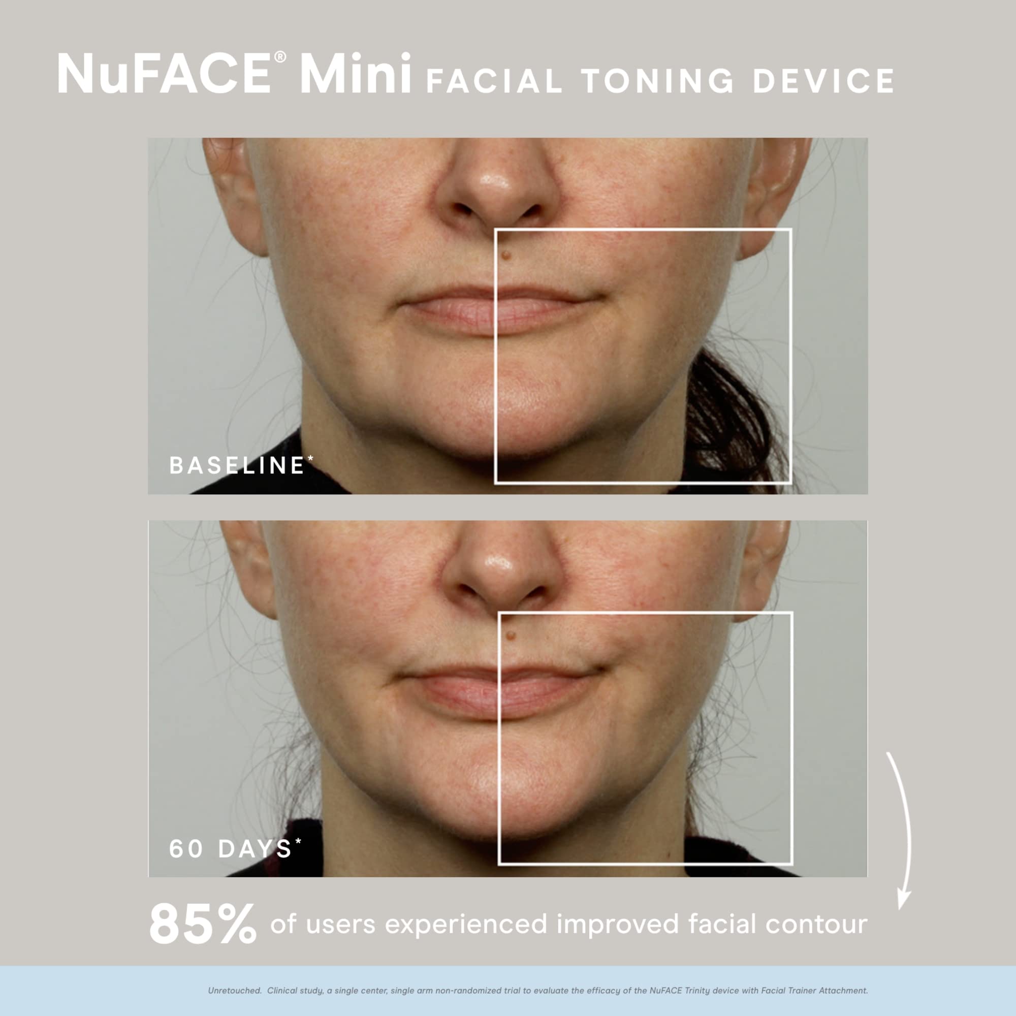 NuFACE Mini Starter Kit. Mini Microcurrent Facial Toning Device with Hydrating Aqua Gel Activator 1.69 Fl Oz