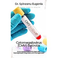 Cytomegalovirus (CMV) Retinitis : Pathogenesis, Diagnosis, and Management Cytomegalovirus (CMV) Retinitis : Pathogenesis, Diagnosis, and Management Kindle Paperback