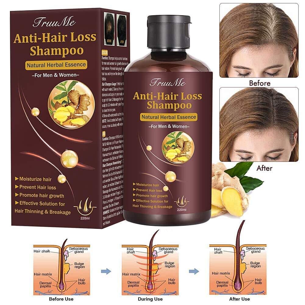 Mua Hair Growth Shampoo, Hair Loss Shampoo, Hair Thickening Shampoo, Helps  Stop Hair Loss, Grow Hair Fast, Hair Loss Treatment for Men & Women (220mL)  trên Amazon Mỹ chính hãng 2023 | Fado