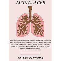 LUNG CANCER LUNG CANCER Kindle Paperback