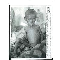 Vintage photo of A famine affected malnourished Ethiopian boy