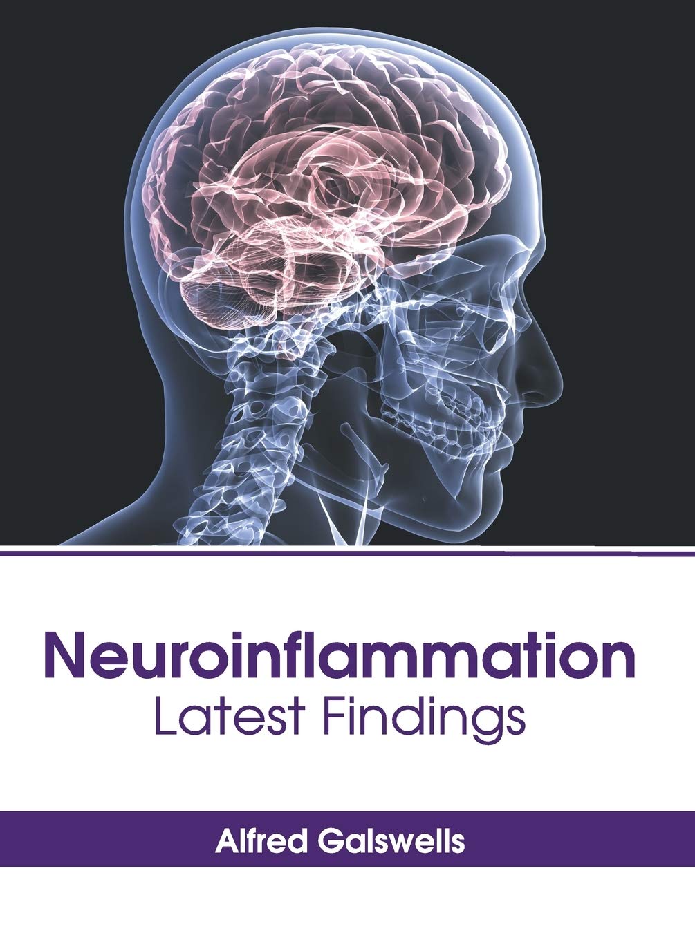 Neuroinflammation: Latest Findings