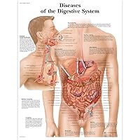 3B Scientific VR1431UU Glossy Paper Diseases of The Digestive System Anatomical Chart, Poster Size 20