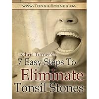 7 Easy Steps to Eliminate Tonsil Stones