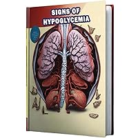 Signs of Hypoglycemia: Identify the signs of hypoglycemia, low blood sugar levels that can lead to symptoms such as shakiness and confusion. Signs of Hypoglycemia: Identify the signs of hypoglycemia, low blood sugar levels that can lead to symptoms such as shakiness and confusion. Paperback