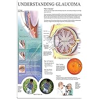Starotore Glaucoma Knowledge Metal Tin Signs Retro Understanding Glaucoma Guide Posters Office Clinic Hospital Home Wall Decor Plaque 12x16 Inches