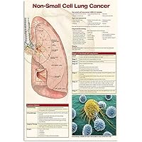 Lung Cancer Knowledge Metal Tin Signs Vintage Non small Cell Lung Cancer Infographic Posters Guidelines Plaques Office Hospital Room Home Wall Decor 12x16 Inches
