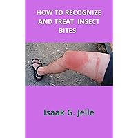 HOW TO RECOGNIZE AND TREAT INSECT BITES