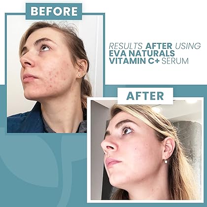 Eva Naturals Vitamin C Serum for Face Plus Hyaluronic Acid, Retinol, Niacinamide & Salicylic Acid, Anti Aging Serum, Reduce Fine Lines, Wrinkles & Dark Spots, Brightening Serum for Glowing Skin (1 oz)