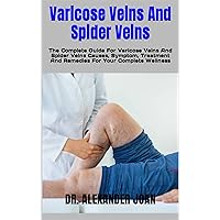 Varicose Veins And Spider Veins : The Complete Guide For Varicose Veins And Spider Veins Causes, Symptom, Treatment And Remedies For Your Complete Wellness Varicose Veins And Spider Veins : The Complete Guide For Varicose Veins And Spider Veins Causes, Symptom, Treatment And Remedies For Your Complete Wellness Kindle Paperback