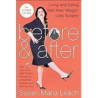 Before & After: Living and Eating Well After Weight-Loss Surgery Before & After: Living and Eating Well After Weight-Loss Surgery Kindle Paperback