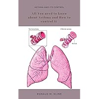 Asthma and its control : All you need to know about Asthma and how to control it. Asthma and its control : All you need to know about Asthma and how to control it. Kindle Paperback