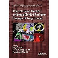 Principles and Practice of Image-Guided Radiation Therapy of Lung Cancer (Imaging in Medical Diagnosis and Therapy) Principles and Practice of Image-Guided Radiation Therapy of Lung Cancer (Imaging in Medical Diagnosis and Therapy) Paperback Kindle Hardcover