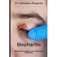 Blepharitis Unveiled: A Comprehensive Exploration (Medical care and health)