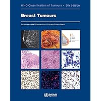 Breast Tumours: WHO Classification of Tumours (Medicine) Breast Tumours: WHO Classification of Tumours (Medicine) Paperback