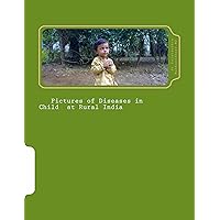 Pictures of Diseases in Child at Rural India (Pictures of Diseases in Rural India Book 1) Pictures of Diseases in Child at Rural India (Pictures of Diseases in Rural India Book 1) Kindle Paperback