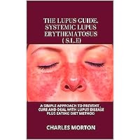 THE LUPUS GUIDE. SYSTEMIC LUPUS ERYTHEMATOSUS ( S.L.E): A SIMPLE APPROACH TO PREVENT , CURE AND DEAL WITH LUPUS DISEASE PLUS EATING DIET METHOD THE LUPUS GUIDE. SYSTEMIC LUPUS ERYTHEMATOSUS ( S.L.E): A SIMPLE APPROACH TO PREVENT , CURE AND DEAL WITH LUPUS DISEASE PLUS EATING DIET METHOD Kindle Paperback
