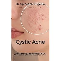 Comprehensive Treatise on Cystic Acne: Understanding, Treatment, and Prevention Comprehensive Treatise on Cystic Acne: Understanding, Treatment, and Prevention Kindle Paperback