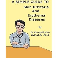 A Simple Guide to Skin Urticaria and Erythema Diseases (A Simple Guide to Medical Conditions) A Simple Guide to Skin Urticaria and Erythema Diseases (A Simple Guide to Medical Conditions) Kindle