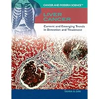 Liver Cancer: Current and Emerging Trends in Detection and Treatment (Cancer and Modern Science) Liver Cancer: Current and Emerging Trends in Detection and Treatment (Cancer and Modern Science) Library Binding