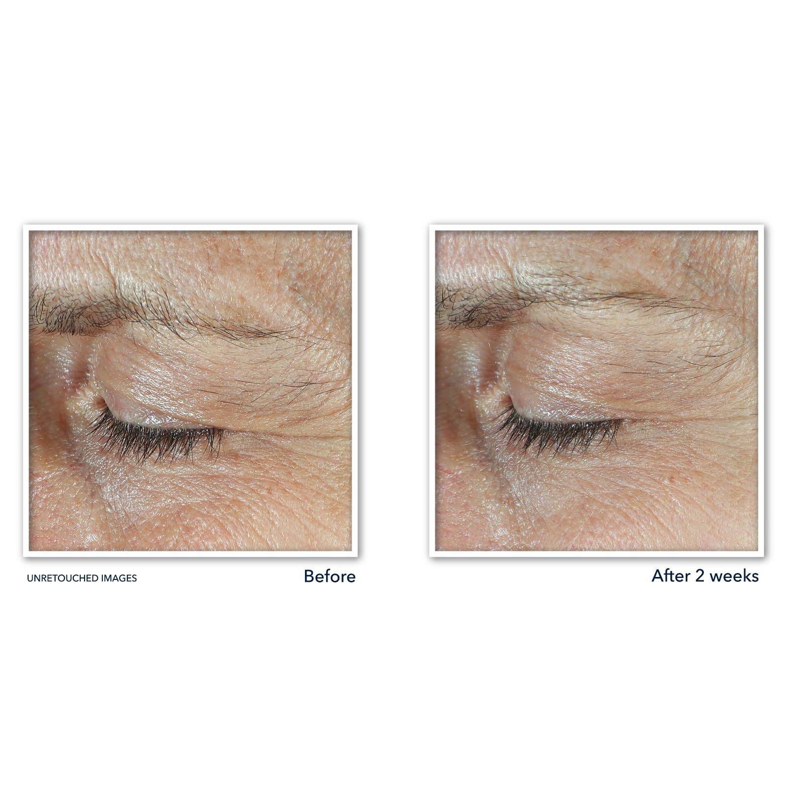 RoC DERM CORREXION DUAL EYE with Line Smoothing Eye Packette