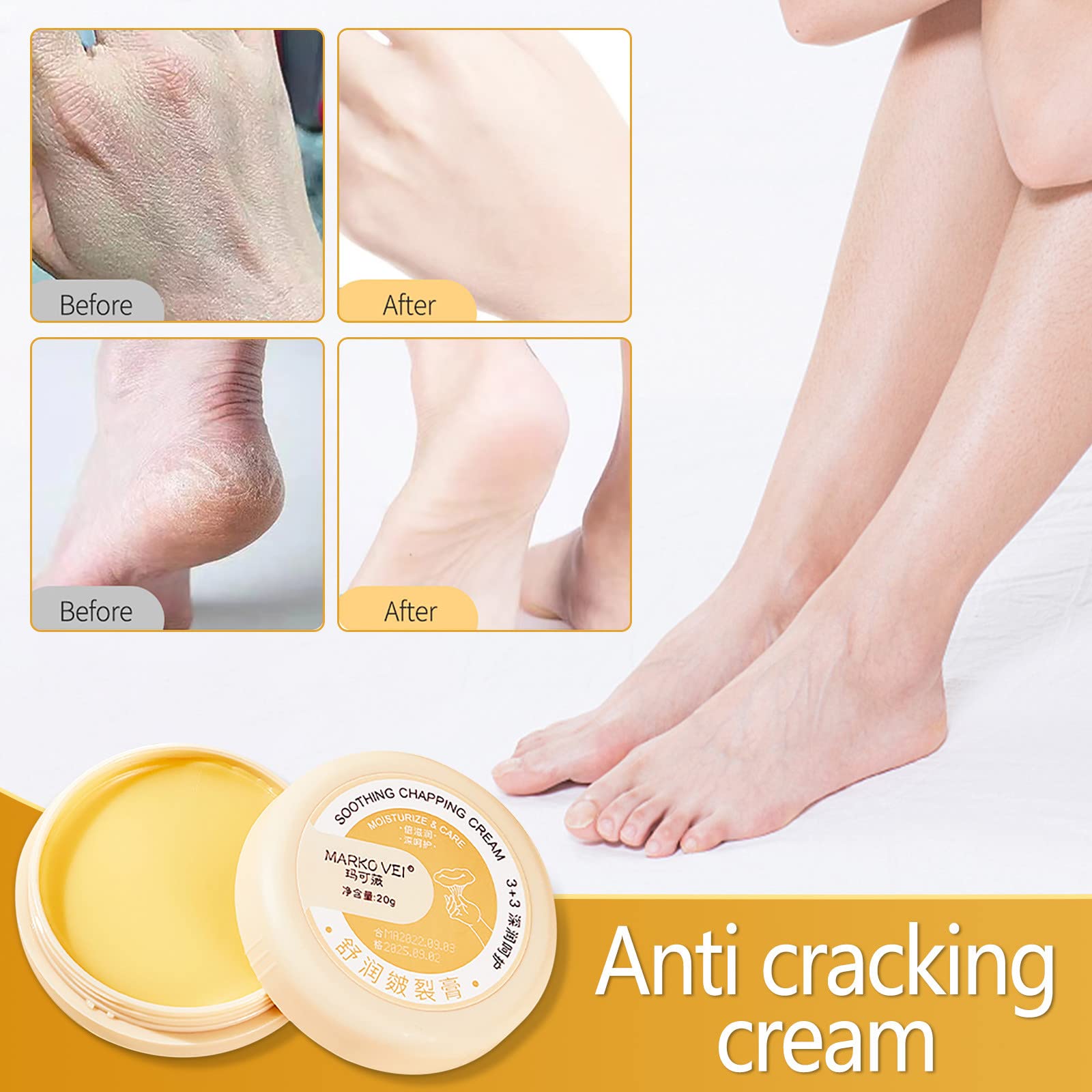 Winter Cracked Skin Repair Cream, 100% Natural Winter Anti-Cracking Frost, Heel Crack Repair Cream, Anti-Cracked Foot Cream, Anti Crack & Hand Foot Cream, Anti Crack Foot Cream for Adults Kids (1PC)