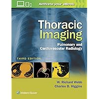 Thoracic Imaging: Pulmonary and Cardiovascular Radiology Thoracic Imaging: Pulmonary and Cardiovascular Radiology Hardcover Kindle