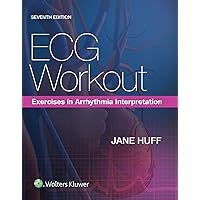 ECG Workout: Exercises in Arrhythmia Interpretation ECG Workout: Exercises in Arrhythmia Interpretation Paperback Kindle