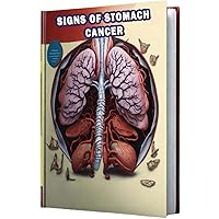 Signs of Stomach Cancer: Explore the signs of stomach cancer, including indigestion, weight loss, and abdominal discomfort. Signs of Stomach Cancer: Explore the signs of stomach cancer, including indigestion, weight loss, and abdominal discomfort. Paperback