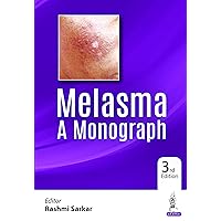 Melasma A Monograph Melasma A Monograph Kindle Paperback