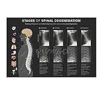 Spinal Degeneration Level Chart Demonstration Chart Spinal Subluxation Art Poster (3) Canvas Poster Bedroom Decor Office Room Decor Gift Unframe-style 12x08inch(30x20cm)